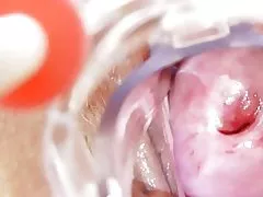 Pis hemşire solo alır